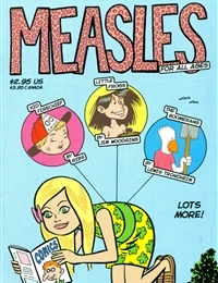 Measles cover