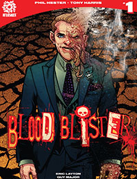 Blood Blister